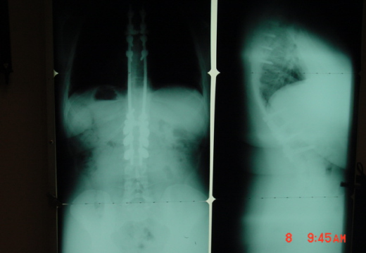 xray 2 (1007 visits) xray 2